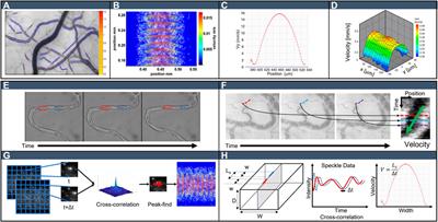 Image-Based Experimental Measurement Techniques to Characterize Velocity Fields in Blood Microflows